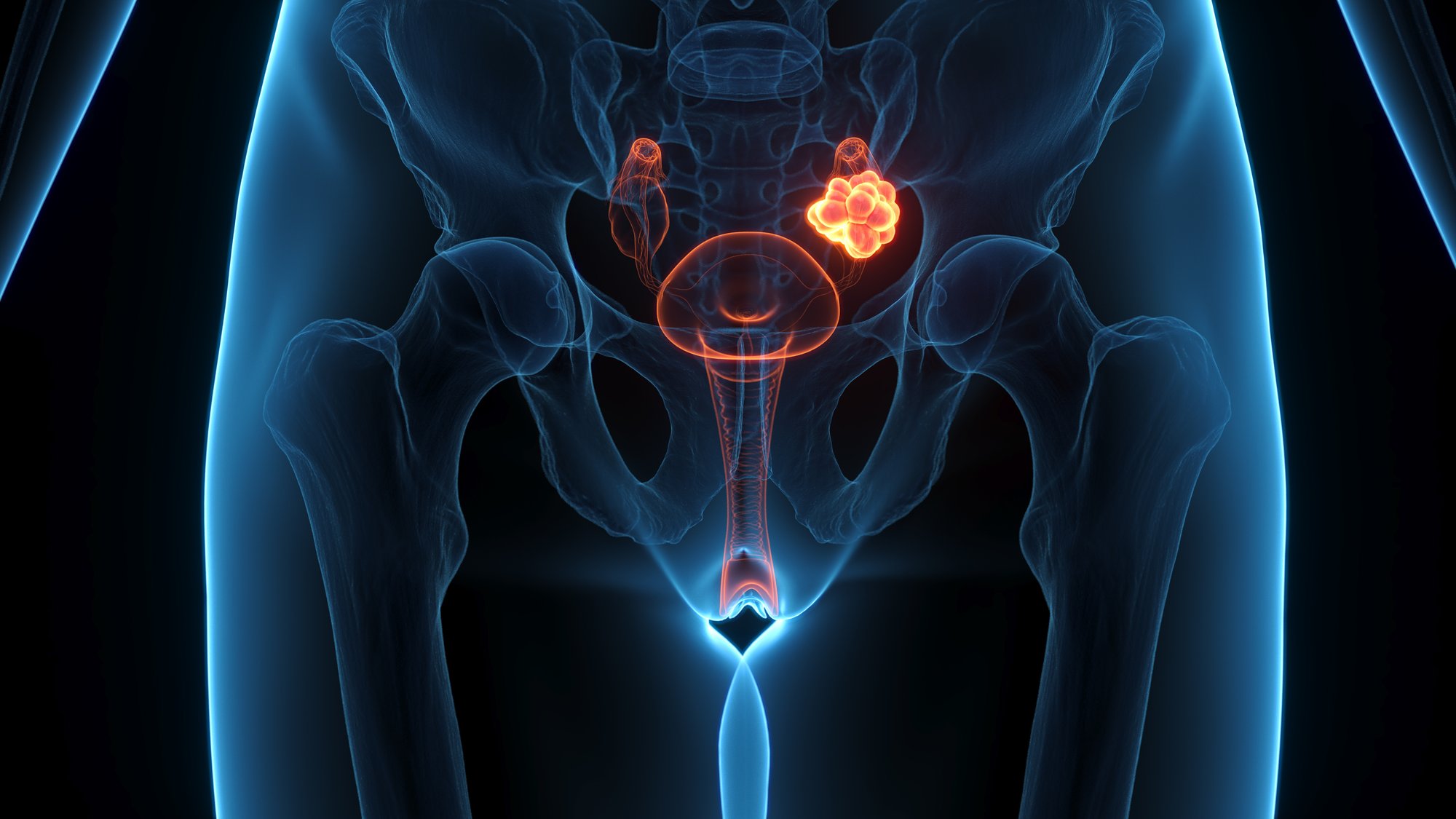 Gynaecological-Cancers-2027