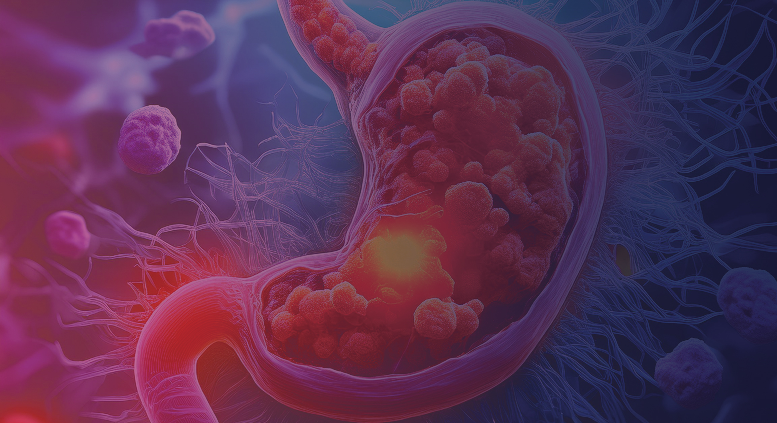 GI-Cancers-26 GI-Cancers-26